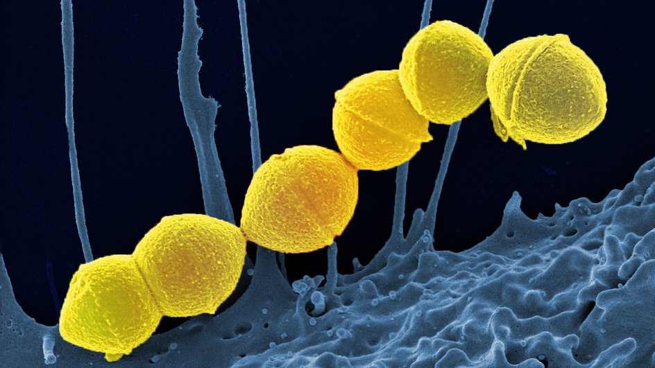 Электронная микрофотография цепочки бактерий Streptococcus pyogenes